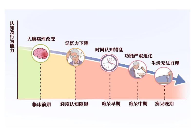认知障碍分期